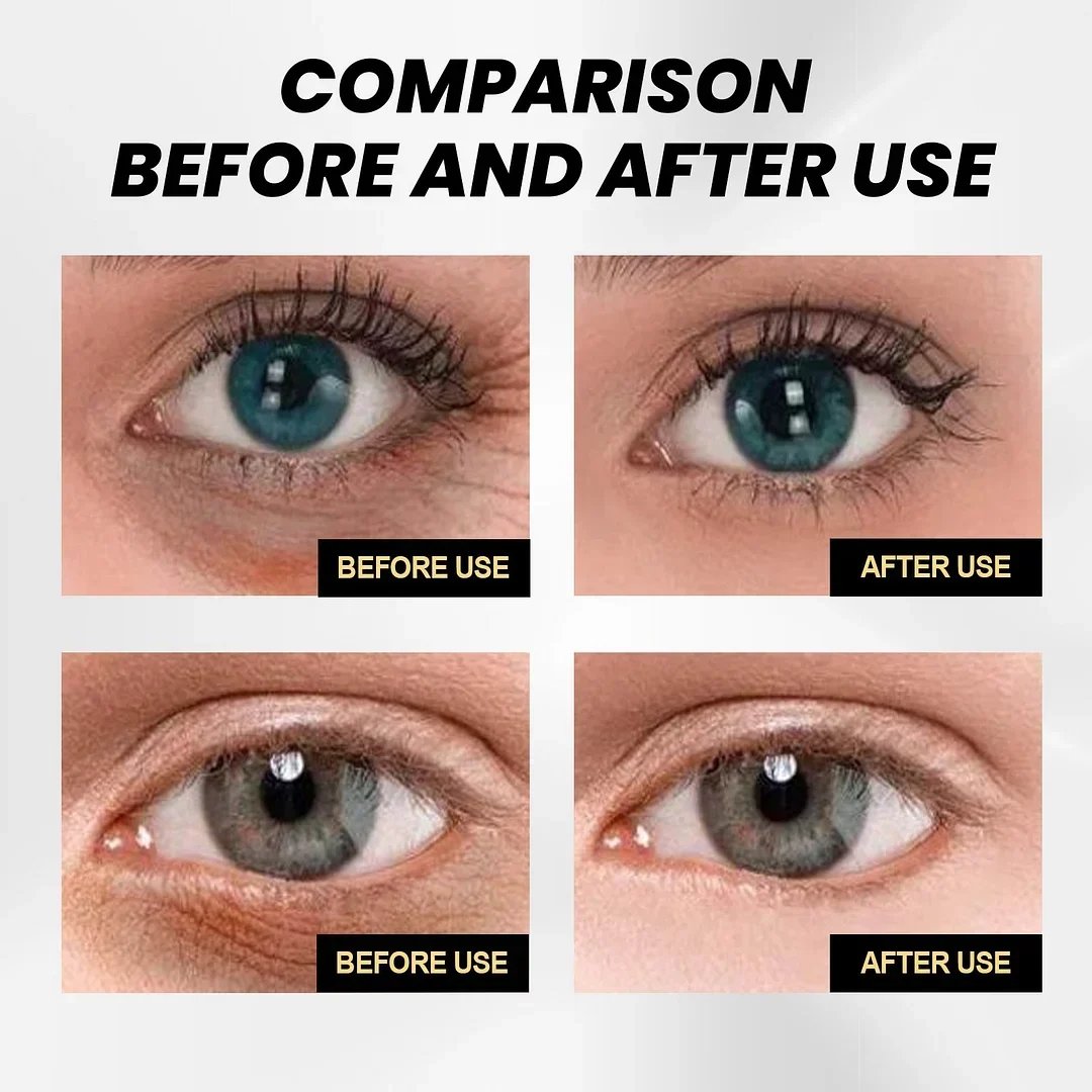 🎁Last Day 65% OFF SALE - Fast Firming Eye Cream🔥