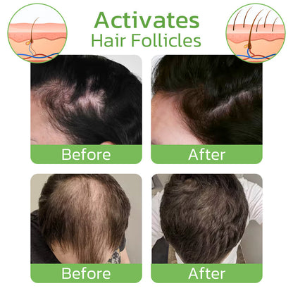 Naotstore - GrowthPlus Nourishing Ginger Spray